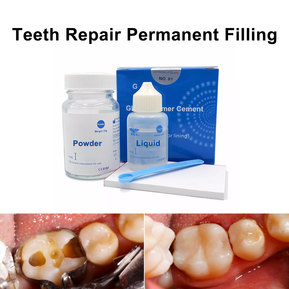 Teeth Whitening At Home Kit - Permanent Zähne Füllung Reparatur Kit Zu