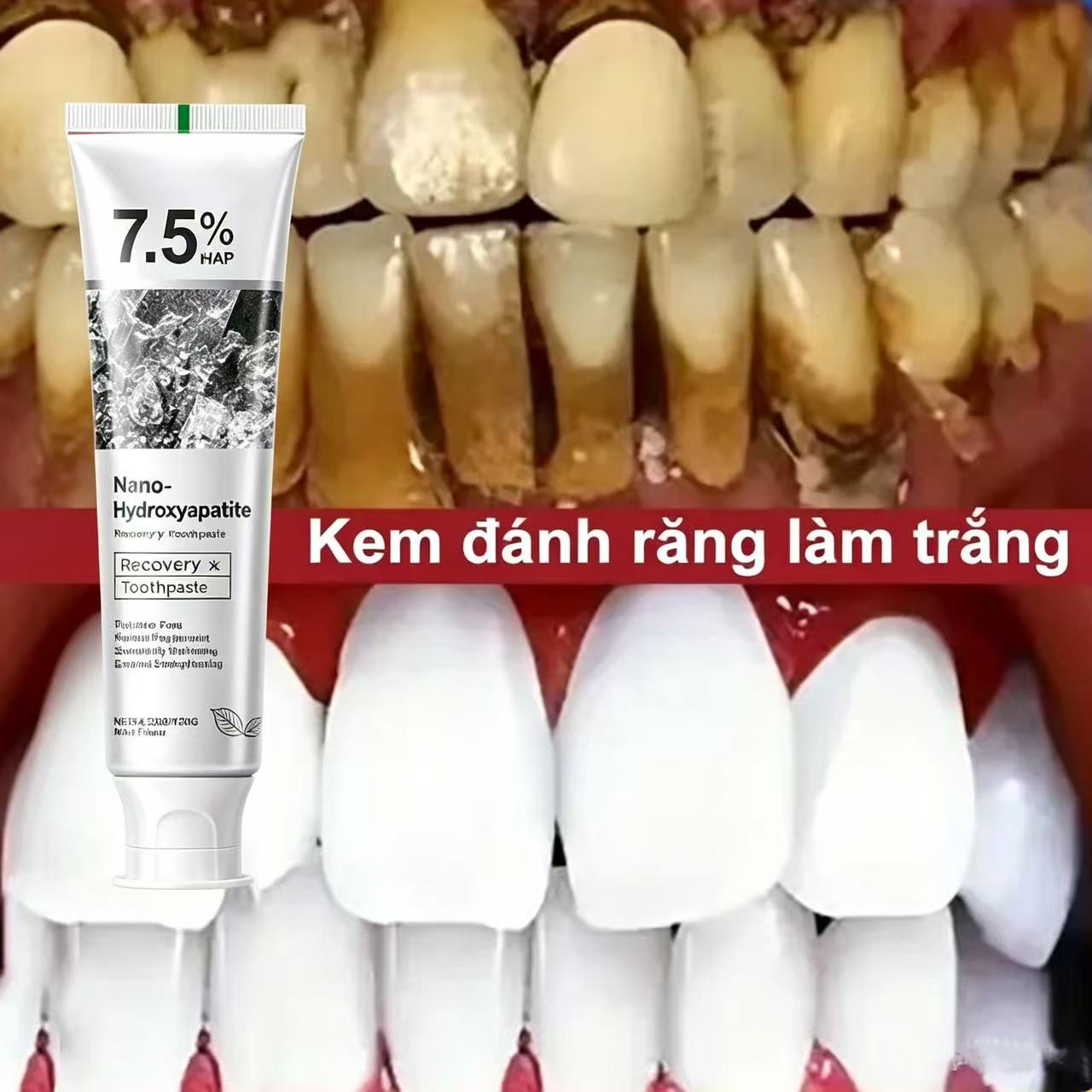 Teeth Whitening That Works - 7,5% Hydroxyapatit Probiotische Zahnaufhellungs-Zahnpasta Zahnschmelz- und