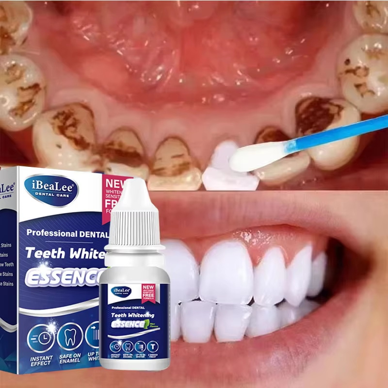 Zahnaufhellungsessenz, entfern – Teeth Whitening Serum Bewertung und Preis