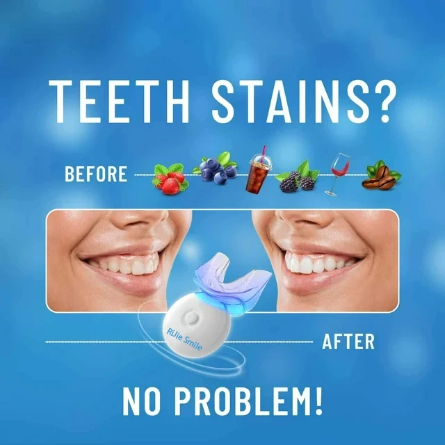 Hochwertiges Reinigungsset Kab – Teeth Whitening At Home Kit Bewertung und Preis