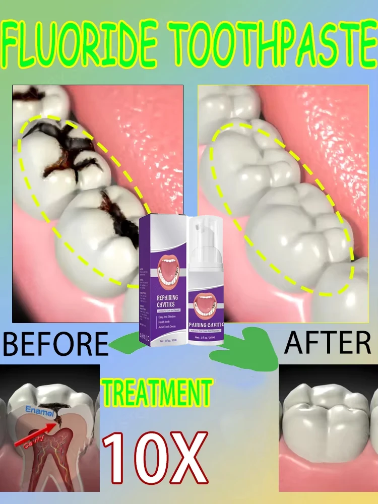 Heiße Verkäufe Bestseller, wis – Teeth Whitening That Works Bewertung und Preis