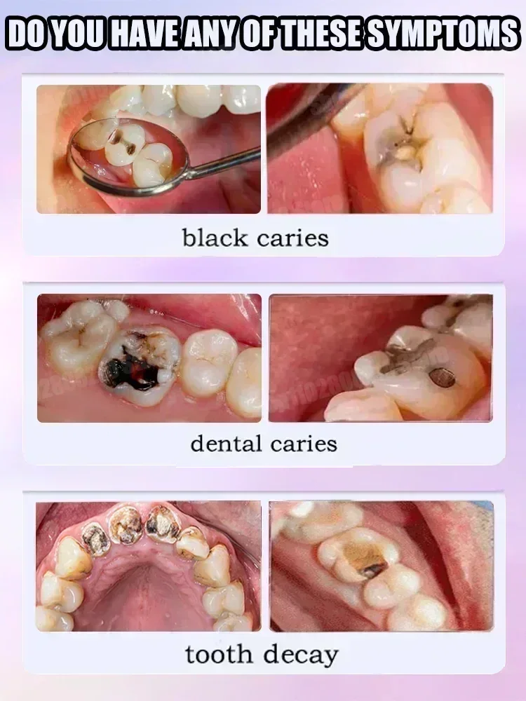 Heiße Verkäufe Bestseller, wis – Teeth Whitening That Works Bewertung und Preis