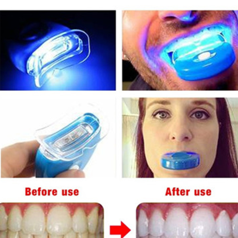Neue Blaue Led Zähne Bleaching – Teeth Whitening Uv Light Bewertung und Preis