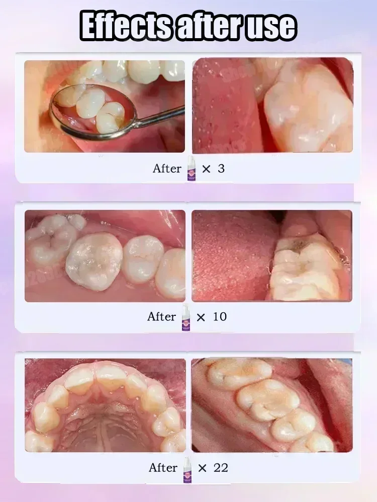 Zahnreinigungs-Zahnpasta entfe – Teeth Whitening That Works Bewertung und Preis