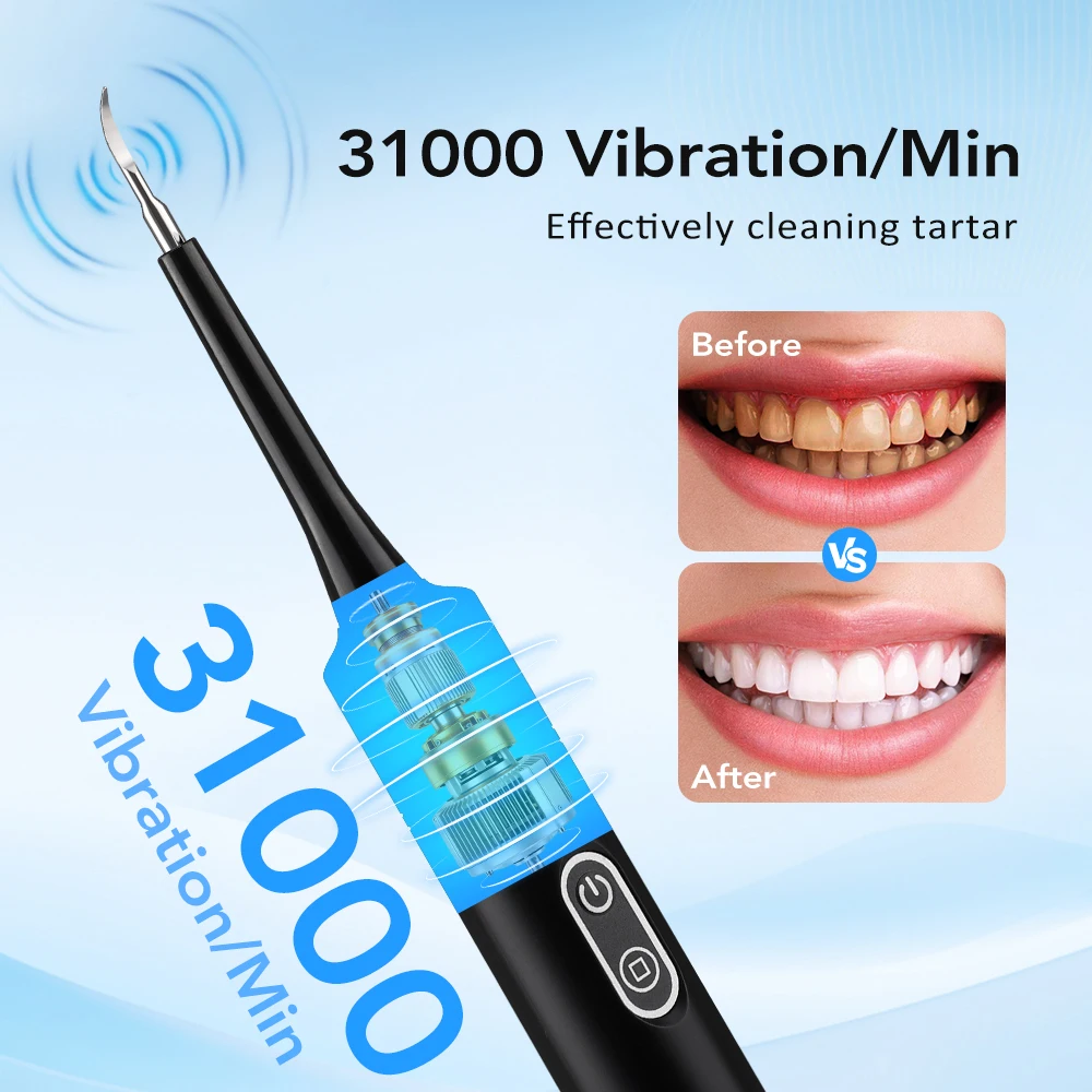 Elektrischer Schallvibrations- – Electric Toothbrush Sonic Bewertung und Preis